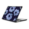 ANEMONE POP by michele frechette | MacBook Pro 14-inch (M1 - M5) / MacBook Bounce Case / Black | Image 1