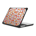 Hot Dogs | MacBook Pro 14-inch (M1 - M5) / MacBook Bounce Case / Black | Image 1